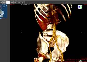 ORPALIS DICOM Viewer Free screenshot