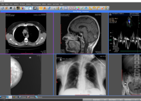 Sante DICOM Editor screenshot