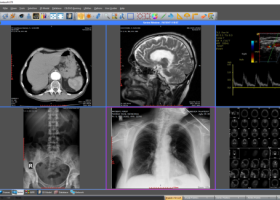 Sante DICOM Viewer Pro screenshot