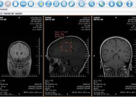 XRayline Workstation screenshot